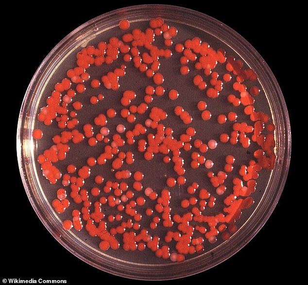 For one week in September of 1950, the US Navy sprayed massive amounts of bacteria into the air two miles off the coast of San Francisco, California. One type was Serratia marcescens