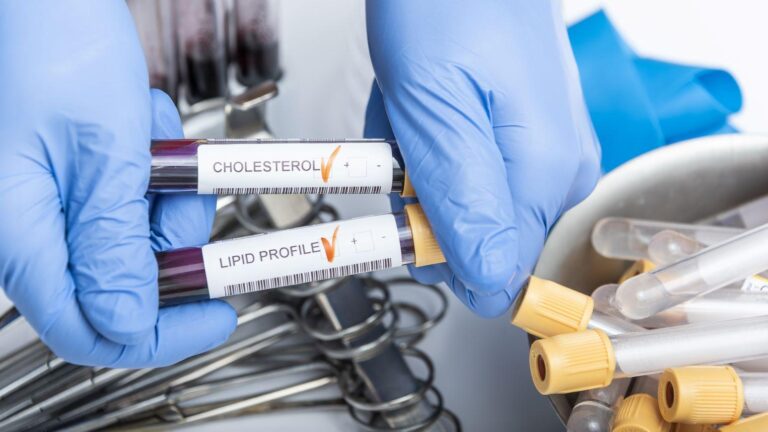 Merck Commits Nearly $2B for Oral Lipid-Lowering Drug from Chinese Biotech – BioSpace